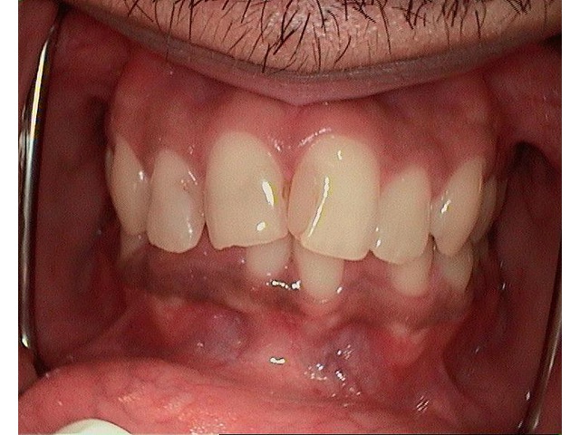 Before Image of Patient