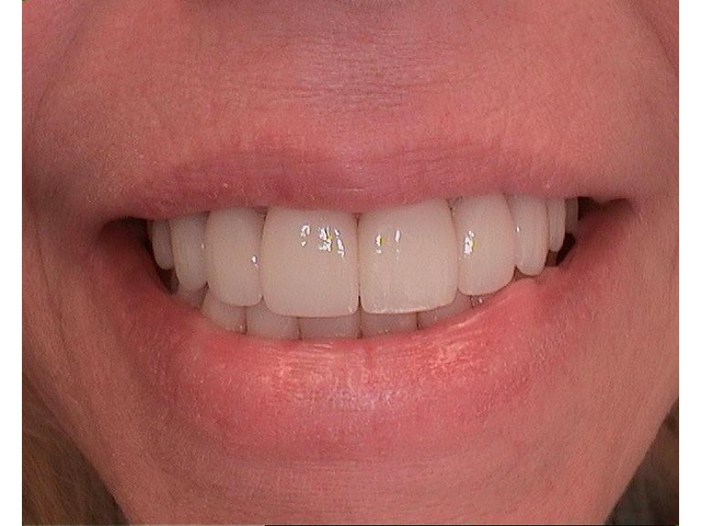 After Image of Patient