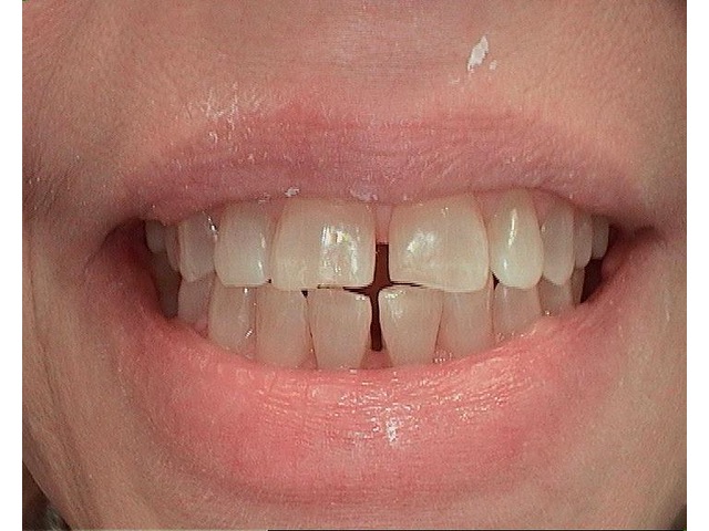 Before Image of Patient
