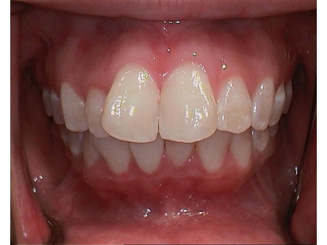 Before Image of Patient