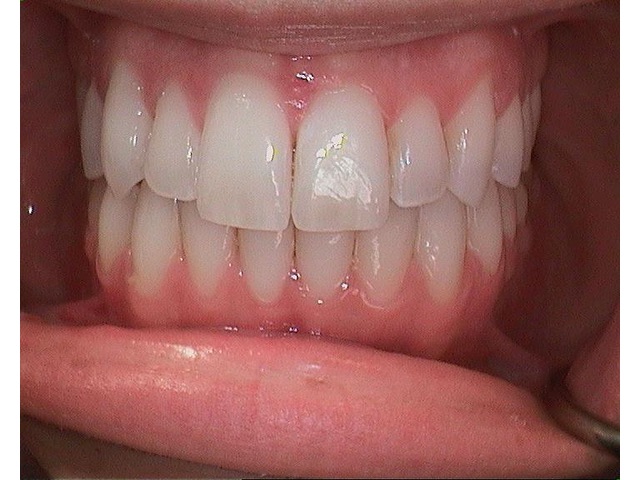 After Image of Patient