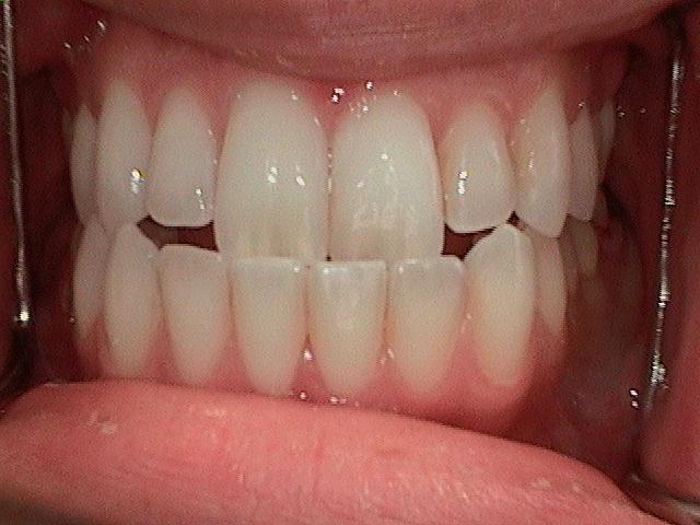 Before Image of Patient