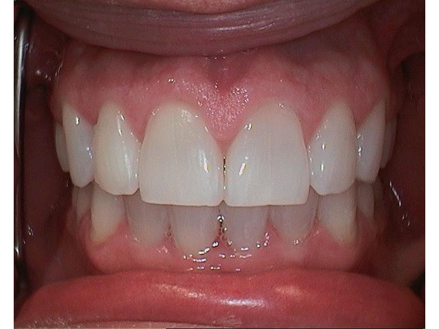 After Image of Patient