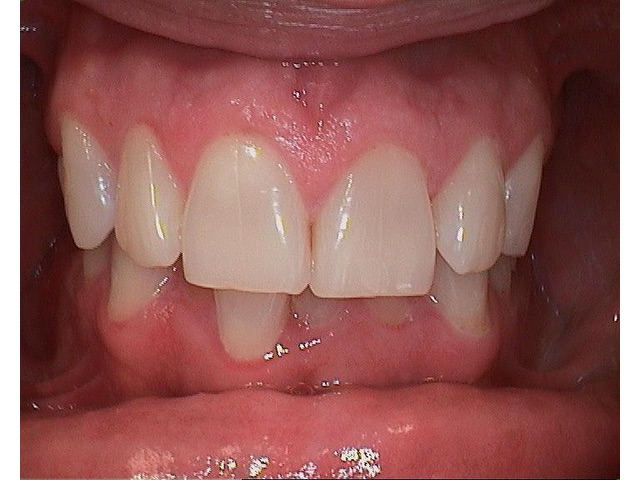 Before Image of Patient