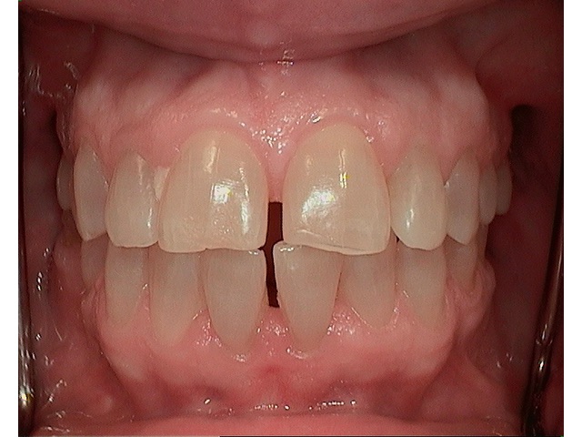 Before Image of Patient